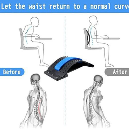 Multi-Level Back Stretcher Posture Corrector Device (Blue)